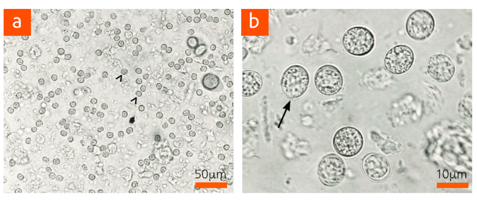 Figure 1: Numerous unsporulated oocysts of Toxoplasma gondii in cat feces