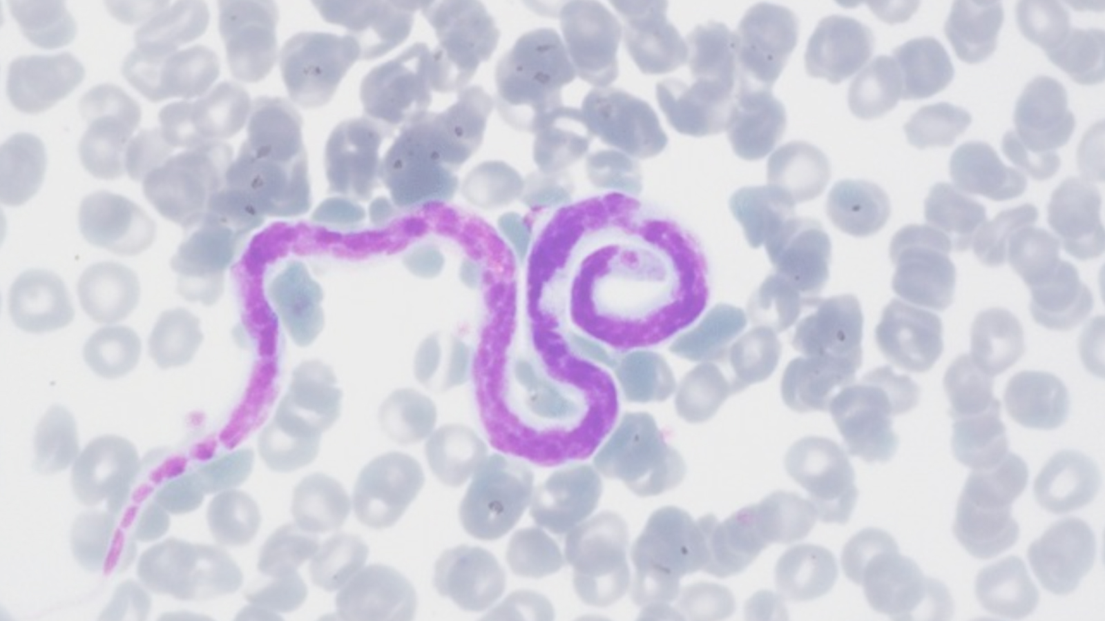 Figure 1. Microscope image of Dirofilaria immitis